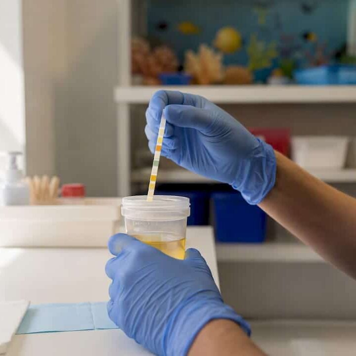 Gloved hands holding urinalysis dipstick near urine sample