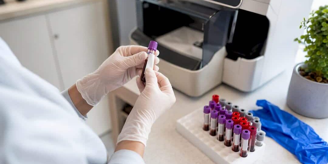1787877179149_Technician-preparing-blood-sample-for-A1C-test Technician preparing blood sample for A1C test