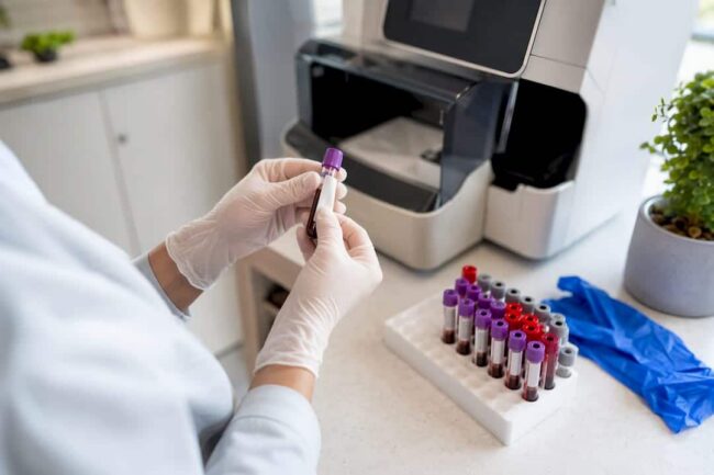 Technician preparing blood sample for A1C test